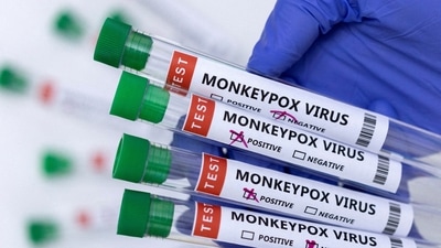 Delhi reported its second monkeypox case. (Representative image) Delhi reported its second monkeypox case. (Representative image)