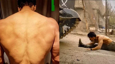 When Tiger Shroff was injured while filming for Baaghi 3. When Tiger Shroff was injured while filming for Baaghi 3.