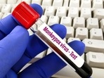 Delhi reports third case of monkeypox, first patient discharged (PIC FOR REPRESENTATION) Delhi reports third case of monkeypox, first patient discharged (PIC FOR REPRESENTATION)