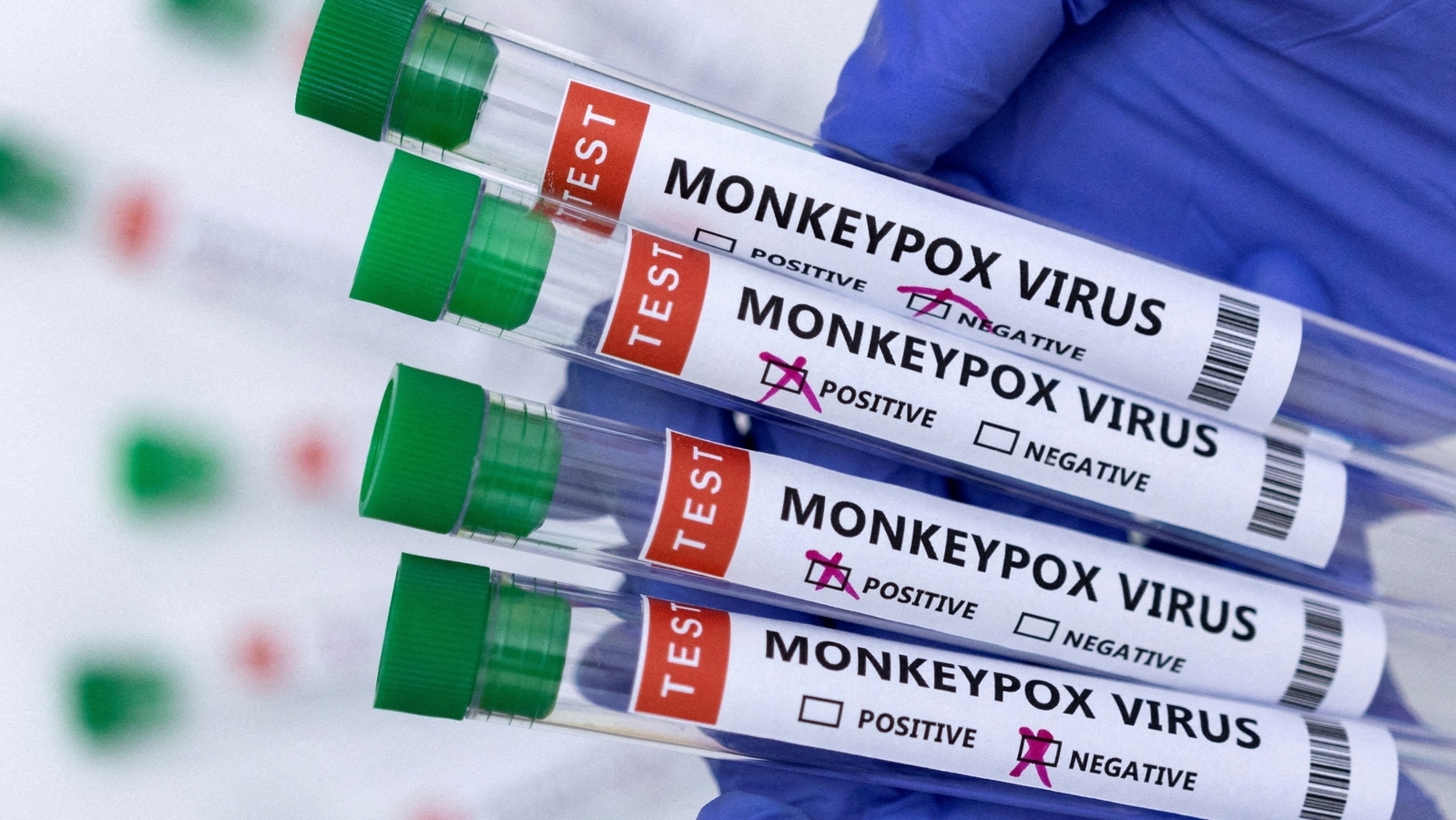 Man, 30, who returned to Kerala from UAE, tests positive for monkeypox, state's tally rises to 5