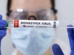 Monkeypox: An expert explains what gay and bisexual men need to know Monkeypox: An expert explains what gay and bisexual men need to know