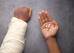 Juvenile arthritis: Causes, symptoms, treatment and all you need to know about arthritis in children (Towfiqu Barbhuiya) Juvenile arthritis: Causes, symptoms, treatment and all you need to know about arthritis in children (Towfiqu Barbhuiya)