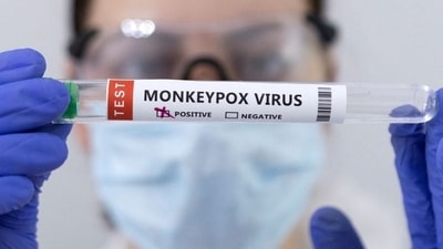 Monkeypox: An expert explains what gay and bisexual men need to know Monkeypox: An expert explains what gay and bisexual men need to know 