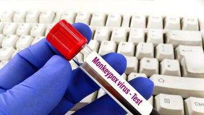 India has so far reported nine cases of the disease and one death. (Shutterstock) India has so far reported nine cases of the disease and one death. (Shutterstock)