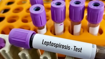 Weil’s Disease: Causes, symptoms, tips to prevent severe form of Leptospirosis (Twitter/91healthtips) Weil’s Disease: Causes, symptoms, tips to prevent severe form of Leptospirosis (Twitter/91healthtips)
