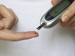 Leucocyte Telomere Length linked to obesity in pre-diabetic and diabetic women(Pixabay) Leucocyte Telomere Length linked to obesity in pre-diabetic and diabetic women(Pixabay)