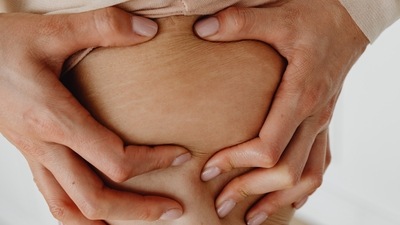 Reduce stretch marks: If you get keloids or scar tissues from a surgery or body piercing then you should use since this ingredient since it stops keloid fibroblasts and scar tissue from reproducing and encourages cell growth. (Pexels) Reduce stretch marks: If you get keloids or scar tissues from a surgery or body piercing then you should use since this ingredient since it stops keloid fibroblasts and scar tissue from reproducing and encourages cell growth. (Pexels)