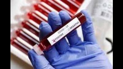 After a nudge from the Centre, the state health department officials have increased Covid testing as the festive season approaches. (REPRESENTATIVE IMAGE)