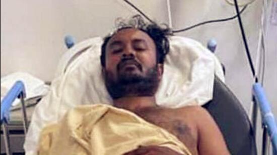 Accused Nagesh Babu, who was waiting in an auto near the workplace of the woman in Bengaluru’s Sunkadakatte, had chased and poured acid on her, the chargesheet said. (ANI) Accused Nagesh Babu, who was waiting in an auto near the workplace of the woman in Bengaluru’s Sunkadakatte, had chased and poured acid on her, the chargesheet said. (ANI)