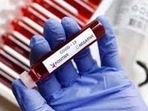 A new Covid-19 test can predict immunity against the virus. A new Covid-19 test can predict immunity against the virus.