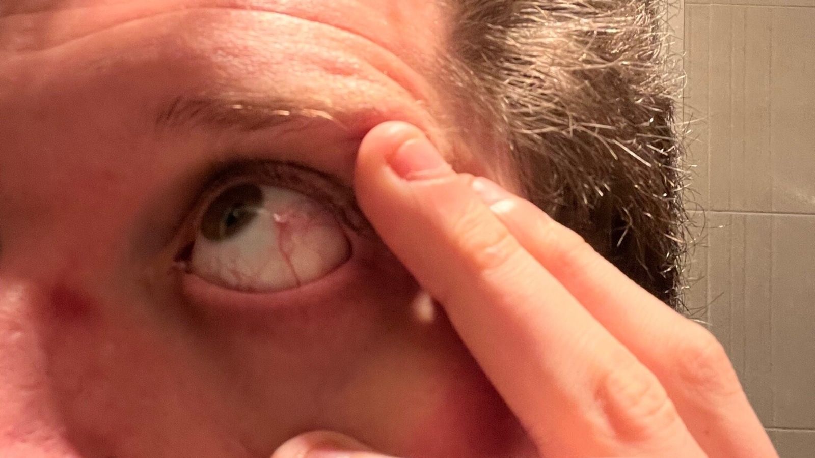 Common Causes of a Sharp Pain in Eye