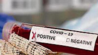 Currently, there are 226 active Covid cases in Ludhiana, of which 215 patients are under home isolation and 11 are undergoing treatment at a private facility. (HT FILE) Currently, there are 226 active Covid cases in Ludhiana, of which 215 patients are under home isolation and 11 are undergoing treatment at a private facility. (HT FILE)