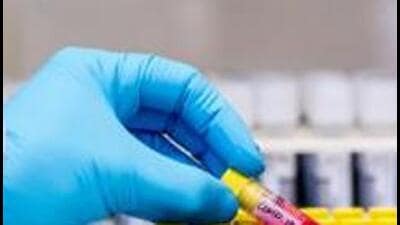 The new animal origin virus is in the same genus as the Nipah virus, and so far these cases have not been fatal or very serious. (Bloomberg File Photo/Representative image) The new animal origin virus is in the same genus as the Nipah virus, and so far these cases have not been fatal or very serious. (Bloomberg File Photo/Representative image)