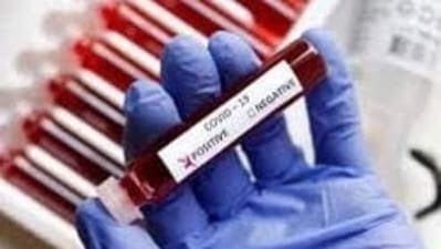 A new Covid-19 test can predict immunity against the virus. A new Covid-19 test can predict immunity against the virus.