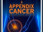 Appendix Cancer Awareness Month 2022: Causes, symptoms and tips on how cancers like carcinoid tumours be treated (Twitter/SunriseOncoCare) Appendix Cancer Awareness Month 2022: Causes, symptoms and tips on how cancers like carcinoid tumours be treated (Twitter/SunriseOncoCare)