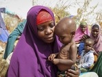 Nunay Mohamed, 25, who fled the drought-stricken Lower Shabelle area, holds her one-year old malnourished child at a makeshift camp for the displaced on the outskirts of Mogadishu, Somalia. (File image)