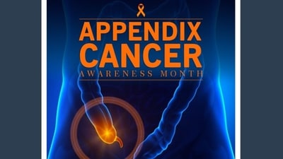 Appendix Cancer Awareness Month 2022: Causes, symptoms and tips on how cancers like carcinoid tumours be treated (Twitter/SunriseOncoCare) Appendix Cancer Awareness Month 2022: Causes, symptoms and tips on how cancers like carcinoid tumours be treated (Twitter/SunriseOncoCare)