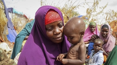 Nunay Mohamed, 25, who fled the drought-stricken Lower Shabelle area, holds her one-year old malnourished child at a makeshift camp for the displaced on the outskirts of Mogadishu, Somalia. (File image) (AP)
