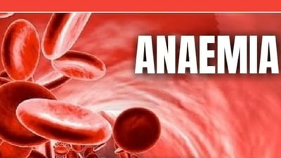 Anaemia in children: Common and uncommon causes, symptoms, treatment in India (Twitter/DOHomoeopathy) Anaemia in children: Common and uncommon causes, symptoms, treatment in India (Twitter/DOHomoeopathy)