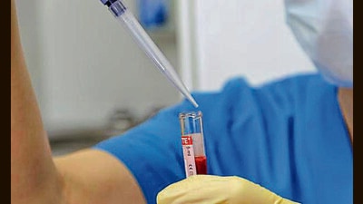 Scientists have observed that prevalence of BA.2.75 subvariant has increased to over 50 per cent in samples tested in Maharashtra. (REORESENTATIVE IMAGE) Scientists have observed that prevalence of BA.2.75 subvariant has increased to over 50 per cent in samples tested in Maharashtra. (REORESENTATIVE IMAGE)