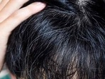 Early greying bothering you? Add this natural ingredient, rich in antioxidants, to your hair care routine (Twitter/theindianmed) Early greying bothering you? Add this natural ingredient, rich in antioxidants, to your hair care routine (Twitter/theindianmed)