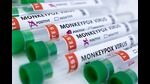 FILE PHOTO: Test tubes labeled FILE PHOTO: Test tubes labeled