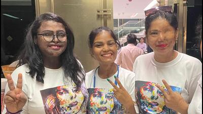 Rupali Vishwakarma (L to R ), Kunti Soni, and Farah Khan posing with victory signs and T-shirts with the message, “My Beauty is my smile”. Rupali Vishwakarma (L to R ), Kunti Soni, and Farah Khan posing with victory signs and T-shirts with the message, “My Beauty is my smile”.