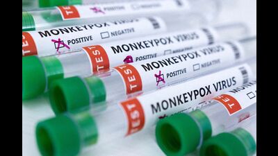FILE PHOTO: Test tubes labeled "Monkeypox virus positive and negative" are seen in this illustration taken May 23, 2022. REUTERS/Dado Ruvic/Illustration (REUTERS)