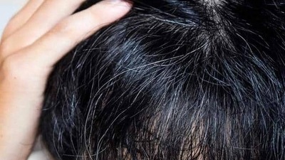 Early greying bothering you? Add this natural ingredient, rich in antioxidants, to your hair care routine&nbsp; (Twitter/theindianmed)
