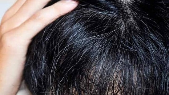 Early greying bothering you? Add this natural ingredient, rich in antioxidants, to your hair care routine&nbsp;(Twitter/theindianmed)