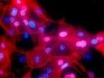 This fluorescence-colored microscope image made available by the National Institutes of Health in September 2016 shows a culture of human breast cancer cells.(AP)
