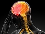 Covid patients at increased risk of psychiatric conditions like dementia and seizures after two years: Study(HT File) Covid patients at increased risk of psychiatric conditions like dementia and seizures after two years: Study(HT File)
