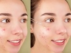 Face serums are a great way to deal with dark spots.