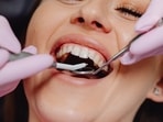 Gum cancer, a form of oral cancer: Early signs, symptoms, stages and treatment
