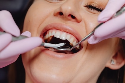 Persistent white or red patches and mouth pain may signal oral cancer, warranting a doctor's visit. (Karolina Grabowska) Persistent white or red patches and mouth pain may signal oral cancer, warranting a doctor's visit. (Karolina Grabowska)