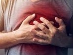 Genetic score identifies those susceptible to sudden cardiac death Genetic score identifies those susceptible to sudden cardiac death