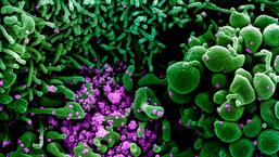 The female patient was a resident of Manimajra, Chandigarh. She was not vaccinated against Covid, and also suffering from cancer, diabetes and respiratory failure. (via REUTERS)