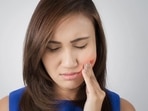 Canker sores, also known as mouth ulcers, are painful sores that occur in the mucous membrane of the oral cavity. These sores develop in the soft tissue lining of your gums, tongue, inner cheeks, lips or palate. While mostly harmless, they can cause pain and a lot of discomforts.(Shutterstock) Canker sores, also known as mouth ulcers, are painful sores that occur in the mucous membrane of the oral cavity. These sores develop in the soft tissue lining of your gums, tongue, inner cheeks, lips or palate. While mostly harmless, they can cause pain and a lot of discomforts.(Shutterstock)