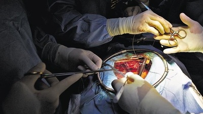 The surgery was on a 32-year-old woman, Laxmi Devi(Representational Image) (Getty Images/Istockphoto) The surgery was on a 32-year-old woman, Laxmi Devi(Representational Image) (Getty Images/Istockphoto)