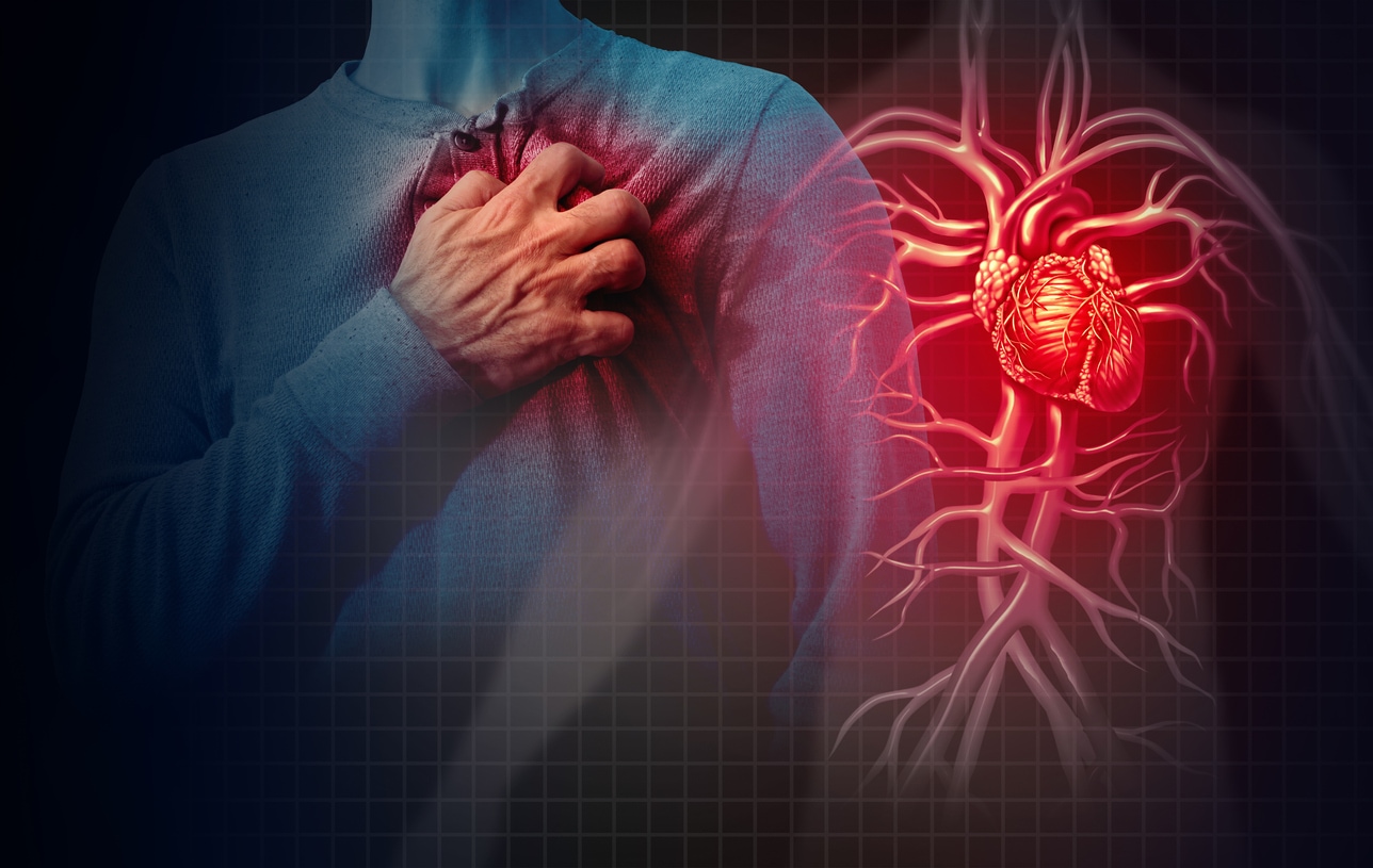 Heart failure (Twitter/PsychiatristCNS) Heart failure (Twitter/PsychiatristCNS)