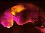 This microscope image shows a synthetic mouse embryo with colors added to show brain and heart formation.(Gianluca Amadei, Charlotte Handford via AP) This microscope image shows a synthetic mouse embryo with colors added to show brain and heart formation.(Gianluca Amadei, Charlotte Handford via AP)