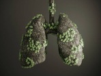 Heart health is at risk due to potential threats from extreme weather: Research(gettyimages) Heart health is at risk due to potential threats from extreme weather: Research(gettyimages)