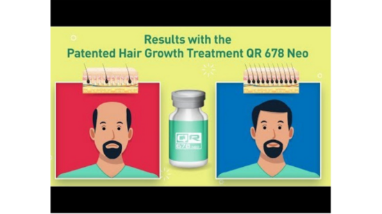 QR678 hair treatment presents a quick response to a problem of hair fall, for which there used to be no solution earlier.