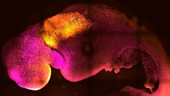 This microscope image shows a synthetic mouse embryo with colors added to show brain and heart formation.(Gianluca Amadei, Charlotte Handford via AP)