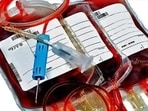 A Gujarati man saved a teenage girl's life in Bengaluru by donating his stem cells 17 years after losing his son to leukaemia.(Picture for representation) A Gujarati man saved a teenage girl's life in Bengaluru by donating his stem cells 17 years after losing his son to leukaemia.(Picture for representation)
