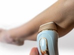 How to get rid of in-grown hair on legs: Dermats share tips