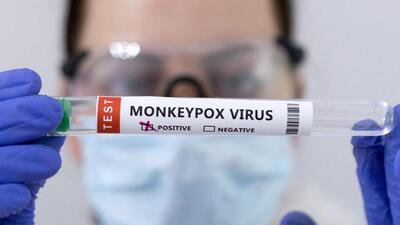 The central government has designated 15 virus research and diagnostic laboratories (VRDLs) spread across 13 states to monitor the incidence of monkeypox in the country, according to people familiar with the matter. (REUTERS) The central government has designated 15 virus research and diagnostic laboratories (VRDLs) spread across 13 states to monitor the incidence of monkeypox in the country, according to people familiar with the matter. (REUTERS)