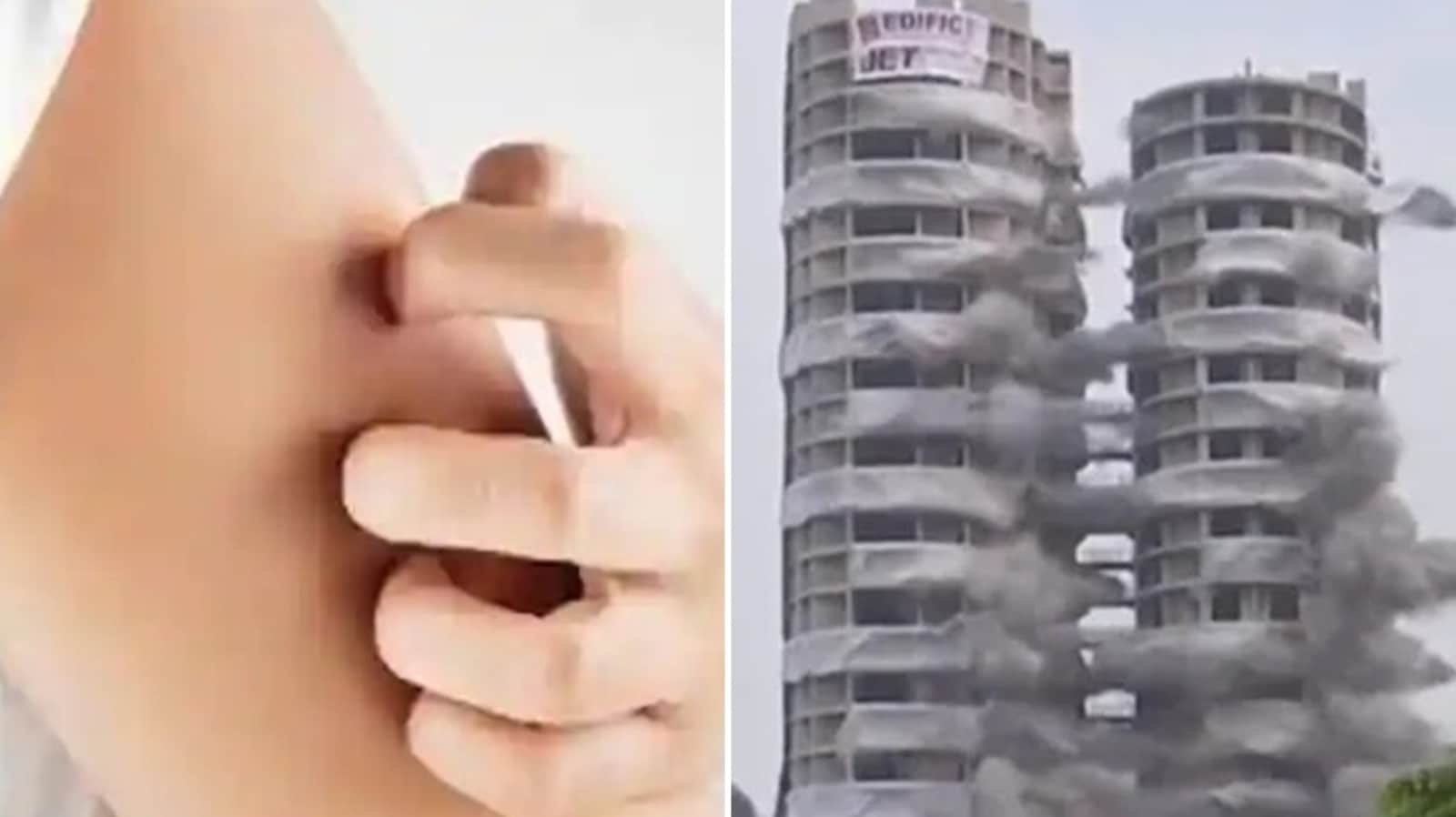 Itchy skin after Noida twin towers demolition? Skincare tips by expert