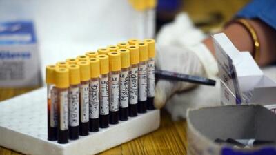 According to the latest report, released on Monday, 21 new patients of BA.5, in addition to 216 patients of BA 2.75 were found. (REPRESENTATIVE PHOTO) According to the latest report, released on Monday, 21 new patients of BA.5, in addition to 216 patients of BA 2.75 were found. (REPRESENTATIVE PHOTO)