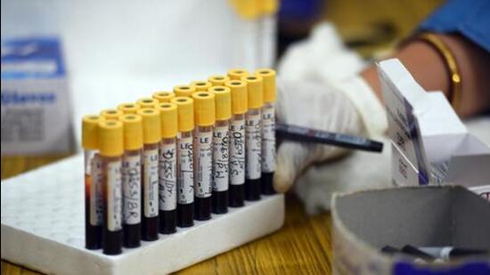 According to the latest report, released on Monday, 21 new patients of BA.5, in addition to 216 patients of BA 2.75 were found. (REPRESENTATIVE PHOTO)